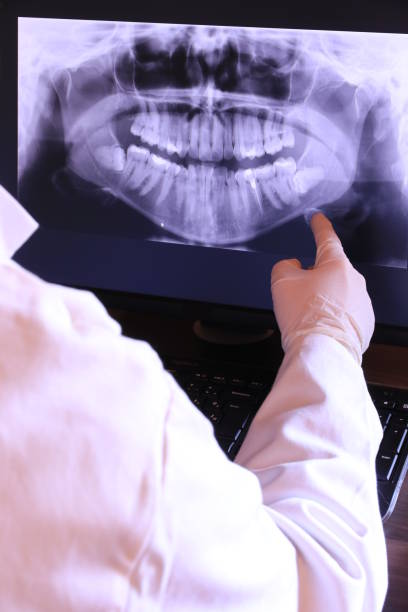 Best Emergency Tooth Extraction in Howe, TX