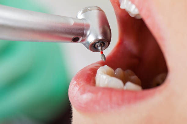 Best Pediatric Emergency Dentist in Howe, TX